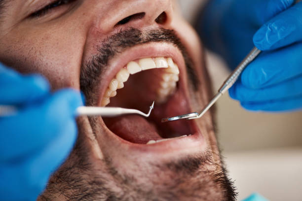 Best Cosmetic Emergency Dentistry in Adamstown, MD