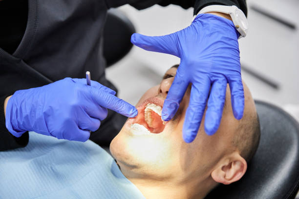 Best Emergency Dental Care for Broken or Chipped Teeth in Adamstown, MD